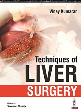 portada Techniques of Liver Surgery (en Inglés)