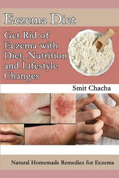 portada Eczema Diet - Get Rid of Eczema with Diet, Nutrition and Lifestyle Changes: Natural Homemade Remedies for Eczema (en Inglés)