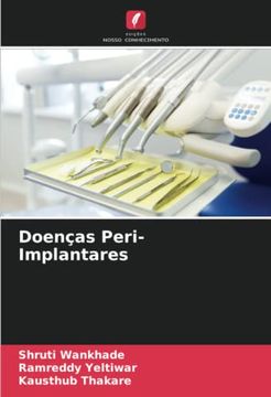 portada Doenças Peri-Implantares: De