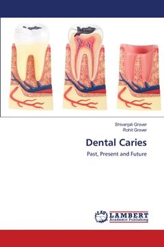 portada Dental Caries (en Inglés)