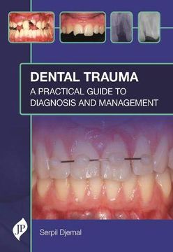 portada Dental Trauma: A Practical Guide to Diagnosis and Management (en Inglés)