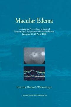 portada Macular Edema: Conference Proceedings of the 2nd International Symposium on Macular Edema, Lausanne, 23-25 April 1998 (en Inglés)