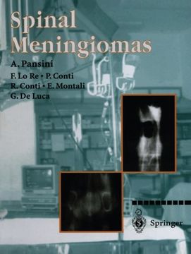 portada Spinal Meningiomas