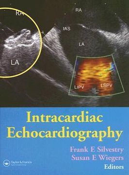 portada Intracardiac Echocardiography (en Inglés)