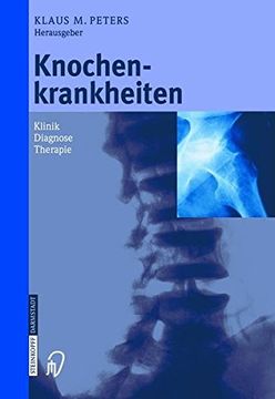 portada Knochenkrankheiten: Klinik Diagnose Therapie