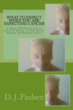 portada What to Expect When You Are Expecting Cancer: A Stage IVB Throat Cancer Survivor Speaks of Life Before During and Beyond Cancer (en Inglés)