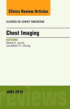 portada Chest Imaging, an Issue of Clinics in Chest Medicine, 1e: Volume 36-2 (The Clinics: Internal Medicine) (en Inglés)