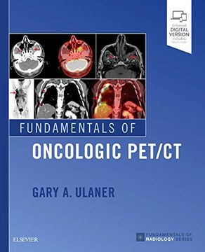 portada Fundamentals of Oncologic pet (in English)