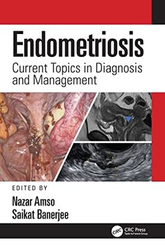 portada Endometriosis: Current Topics in Diagnosis and Management (en Inglés)