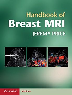 portada Handbook of Breast mri (en Inglés)