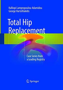 portada Total Hip Replacement: Case Series from a Leading Registry (en Inglés)