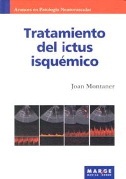portada Tratamiento del ictus isquémico (in Spanish)