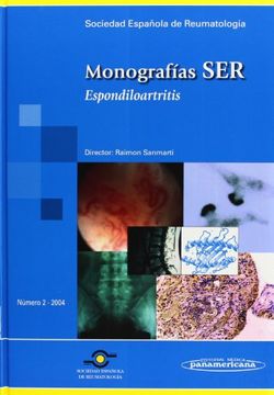 portada Monografía SER: Espondiloartritis