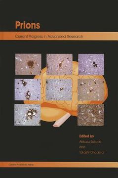 portada prions: current progress in advanced research (en Inglés)