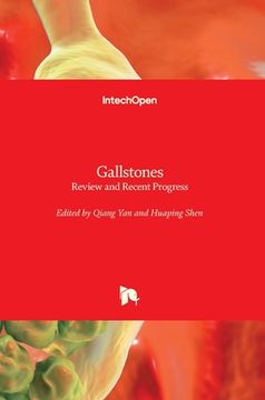 portada Gallstones: Review and Recent Progress (en Inglés)