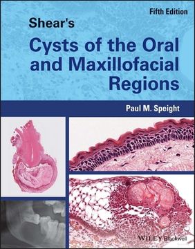portada Shear's Cysts of the Oral and Maxillofacial Regions (en Inglés)