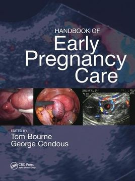 portada Handbook of Early Pregnancy Care (en Inglés)