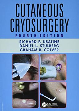 portada Cutaneous Cryosurgery (en Inglés)