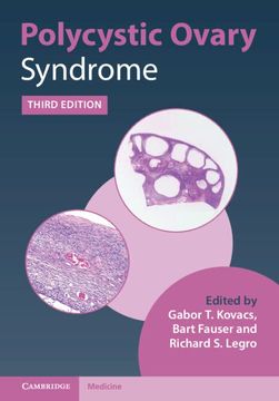 portada Polycystic Ovary Syndrome (in English)