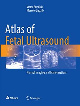 portada Atlas of Fetal Ultrasound: Normal Imaging and Malformations (en Inglés)