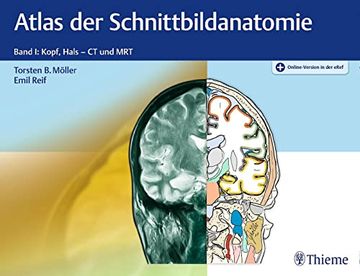portada Atlas der Schnittbildanatomie: Band i: Kopf, Hals (en Alemán)