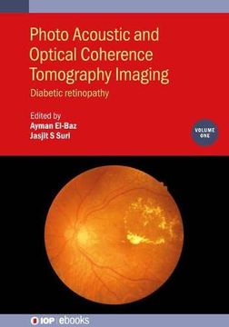 portada Photo Acoustic and Optical Coherence Tomography Imaging: Diabetic Retinopathy (Volume 1) (en Inglés)
