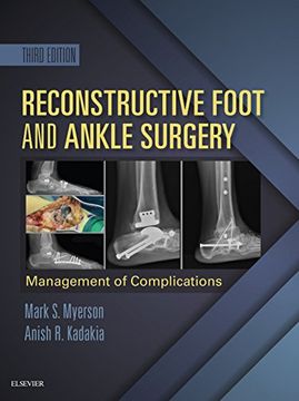 portada Reconstructive Foot And Ankle Surgery: Management Of Complications 3 Revised edition 