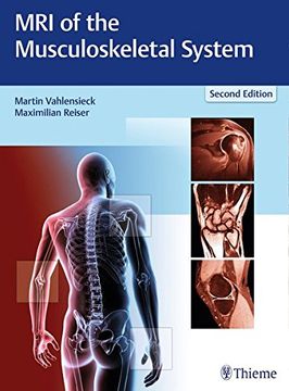 portada MRI of the Musculoskeletal System (en Inglés)