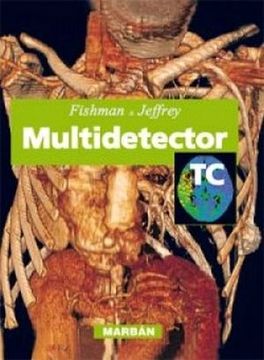 portada FISHMAN. MULTIDETECTOR. TC