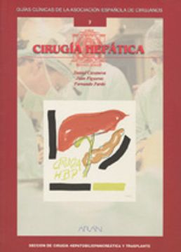 portada Cirugia hepatica (guias clinicas de la asociacion española de cirujanos nº 7)