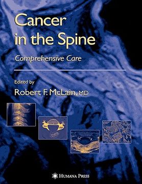 portada Cancer in the Spine: Comprehensive Care (en Inglés)