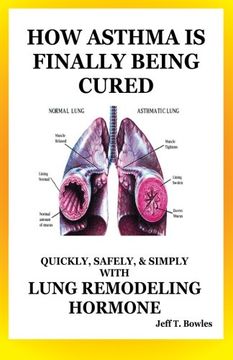 portada How Asthma is Finally Being Cured: Quickly, Safely, & Simply With Lung-Remodeling Hormone (en Inglés)