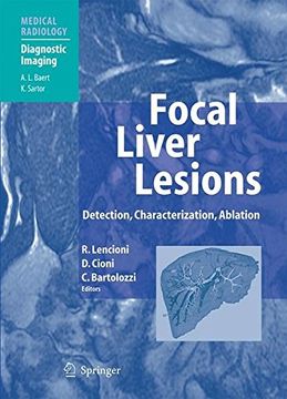 portada focal liver lesions: detection, characterization, ablation (en Inglés)
