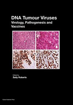 portada DNA Tumour Viruses: Virology, Pathogenesis and Vaccines