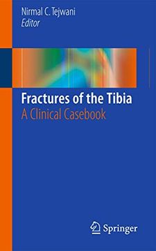 portada Fractures of the Tibia: A Clinical Casebook (en Inglés)