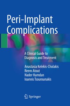 portada Peri-Implant Complications: A Clinical Guide to Diagnosis and Treatment (en Inglés)