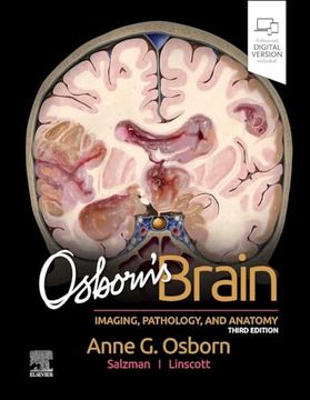 portada Osborn's Brain (in English)