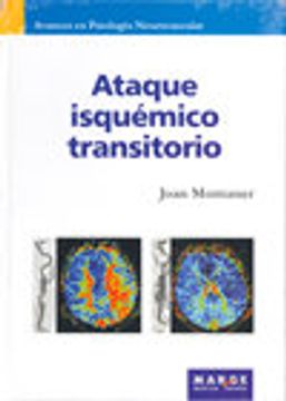 portada ataque isquémico transitorio