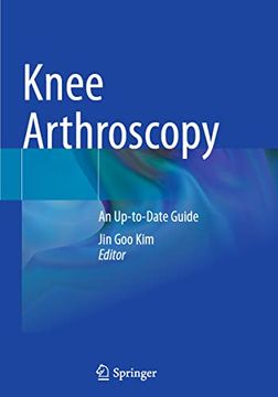 portada Knee Arthroscopy: An Up-To-Date Guide (in English)