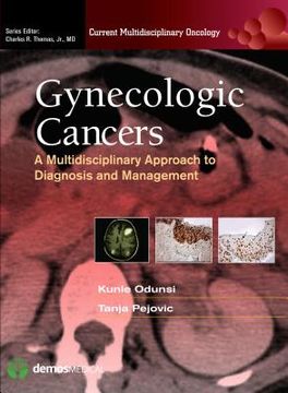 portada Gynecologic Cancers: A Multidisciplinary Approach to Diagnosis and Management (in English)