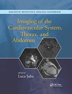 portada Imaging of the Cardiovascular System, Thorax, and Abdomen (en Inglés)