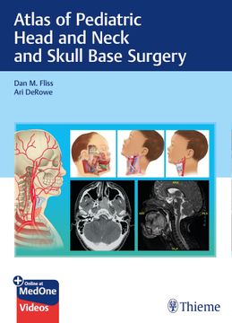 portada Atlas of Pediatric Head and Neck and Skull Base Surgery (en Inglés)