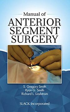 portada Manual of Anterior Segment Surgery (en Inglés)