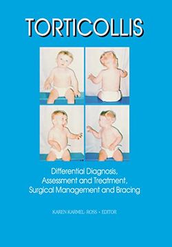 portada Torticollis: Differential Diagnosis, Assessment and Treatment, Surgical Management and Bracing (Physical & Occupational Therapy in Pediatrics, v. 17, no. 2) (in English)