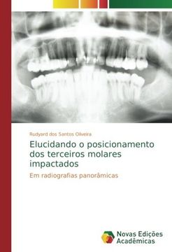 portada Elucidando o posicionamento dos terceiros molares impactados: Em radiografias panorâmicas