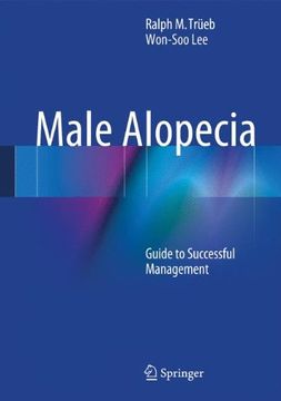 portada Male Alopecia: Guide to Successful Management