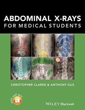 portada Abdominal X-Rays for Medical Students (en Inglés)