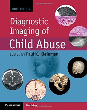portada Diagnostic Imaging of Child Abuse