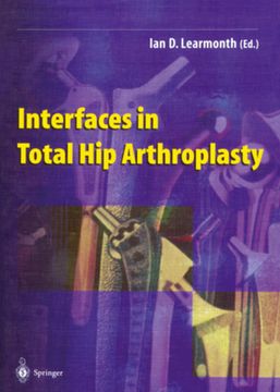portada Interfaces in Total Hip Arthroplasty (en Inglés)