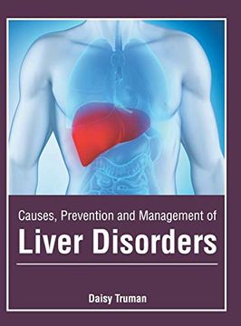portada Causes, Prevention and Management of Liver Disorders 